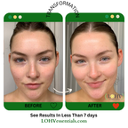 Hyper Hydrator SPF 30 Moisturizer — product image 7