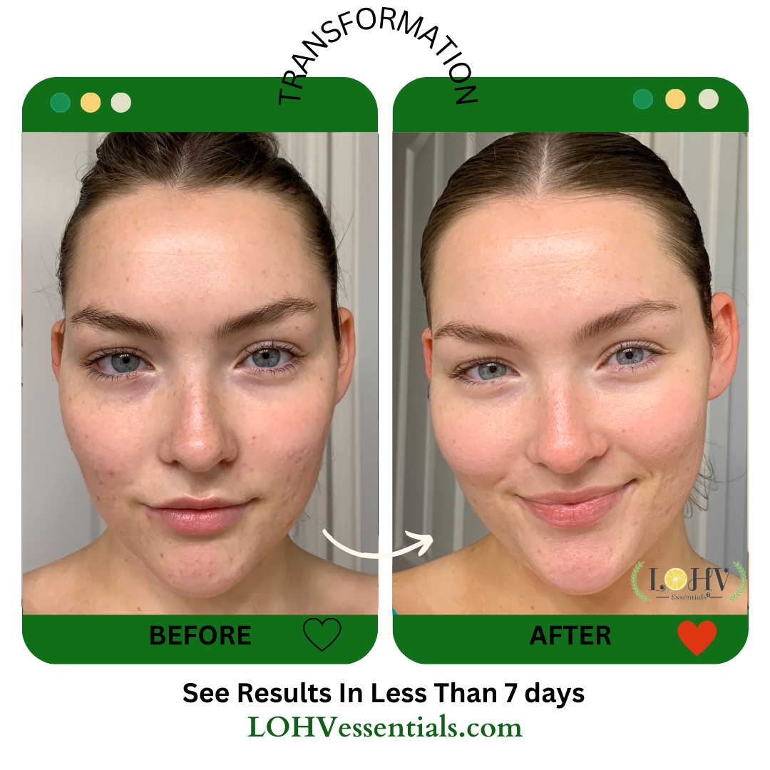 Hyper Hydrator SPF 30 Moisturizer — product image 7