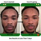 Glow Up Toner Serum — product image 9
