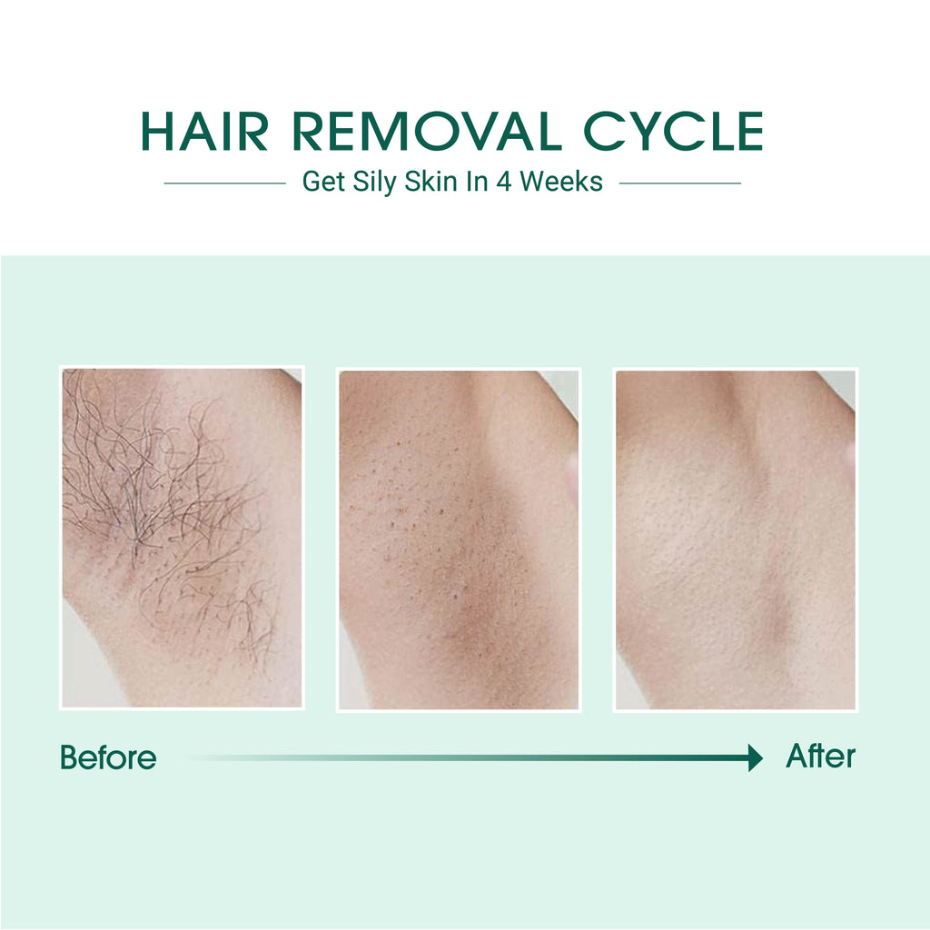 At-Home IPL Hair Removal Device — product image 5